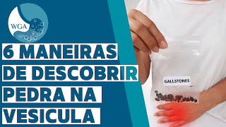 6 MANEIRAS DE DESCOBRIR PEDRA NA VESÍCULA