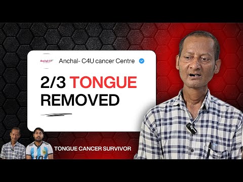 Advanced Tongue Cancer Surgery
