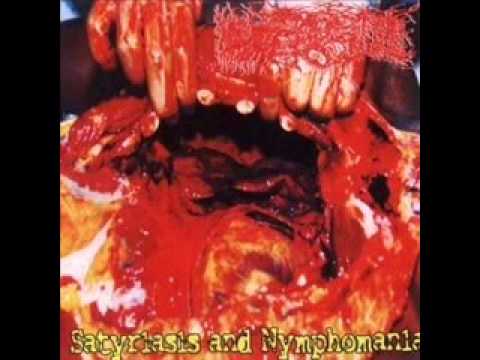 paracoccidio...-necroexpulsion gangrenosa por SIDA