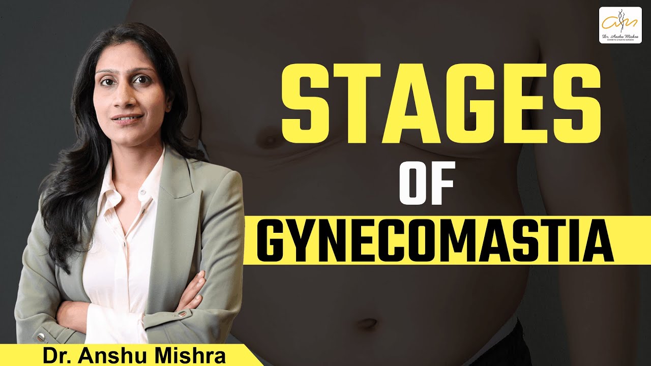 Understanding the Different Grades of Gynecomastia | Stages of Gynecomastia | Dr. Anshu Mishra