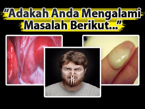 Tentang potensi program hidup sehat Pengaruh faktor lingkungan terhadap potensi