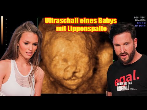 MICHAEL WENDLER + LAURA MÜLLER schwanger mit zweitem Kind: Doch leider ist das Baby...