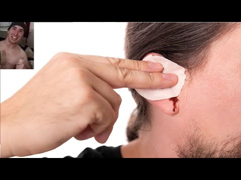 J'ai perdu l'audition.