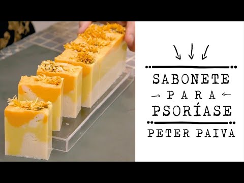 Psoriasis Soap - Peter Paiva