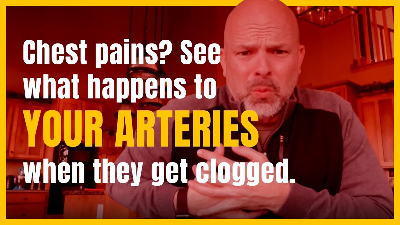 What is costochondritis and how is it treated? Tipseri