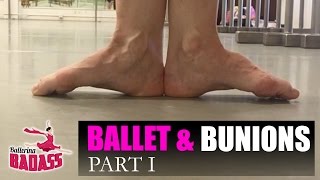 Ballet & Bunions Part I: How To Stretch, Strengthen, & Prevent Pain with Ballerina Badass
