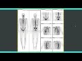 Essentials Of Nuclear Medicine And Molecular Imaging 7th Edition Pdf