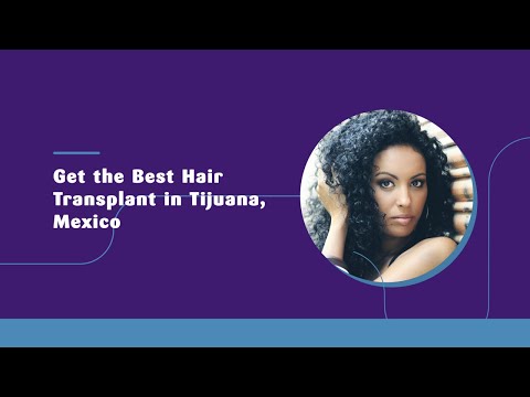 Get the Best Hair Transplant in Tijuana, Mexico