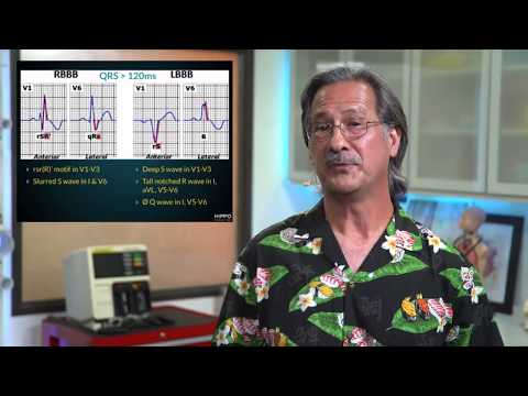 Hippo Short: RBBB vs LBBB on an ECG