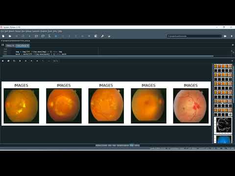 Cardiovascular Disease Classification in Python Projects