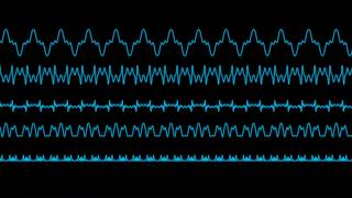 Video thumbnail for Turbo for Korg multi engine by Sinevibes