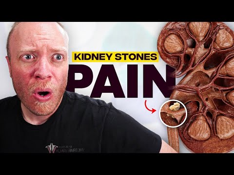 , title : 'The Most PAINFUL Thing a Human Can Experience?? | Kidney Stones'