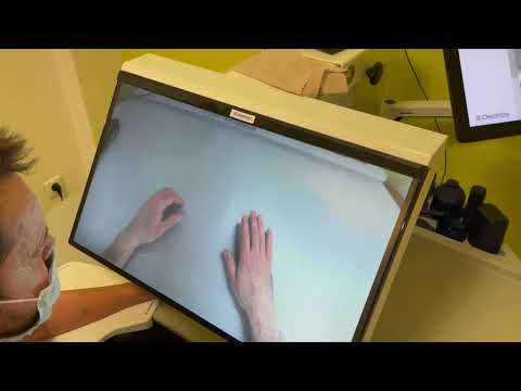 Physiotherapy 11 months after arm transplant