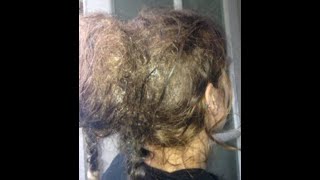 How To Detangle Severely Matted Hair Without Cutting | How To Detangle Badly Matted Hair At Home
