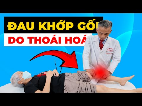 Sợ Không Đi Lại Được Vì Thoái Hóa Gối? Bác Sĩ Hé Lộ Bí Quyết Phục Hồi