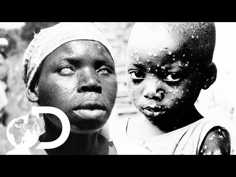 The Eradication Of Smallpox | Invisible Killers