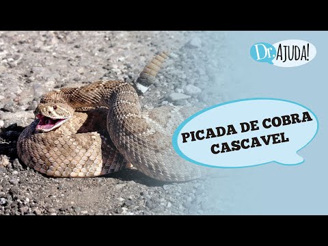 What to do after a rattlesnake bite?