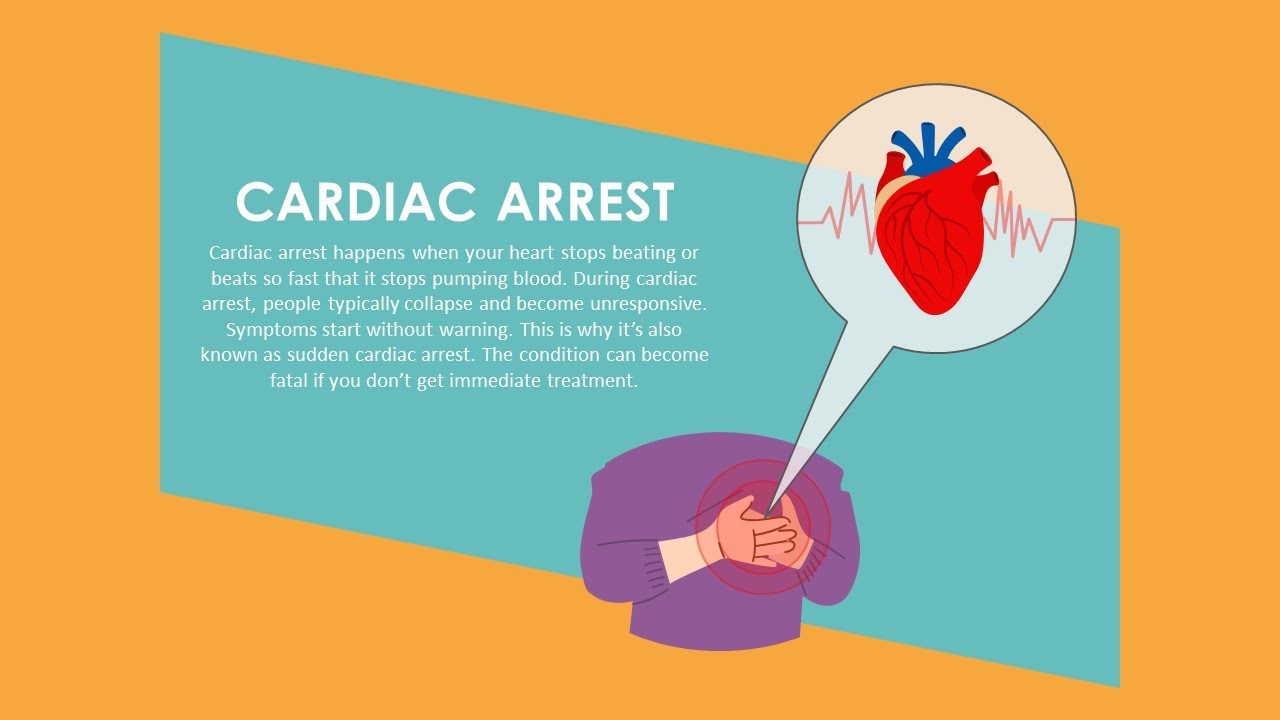 Cardiac Arrest Animated PowerPoint Slides