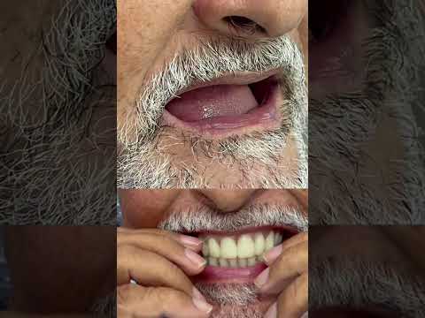 video dVvpLMxfgDM