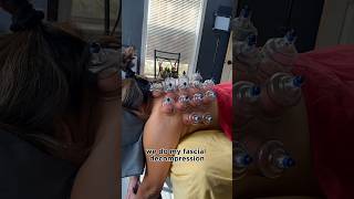 Download lagu Punggung yang buruk #backpain #trap #massage #cupping #timelapse #sportsmassage #arttherapy #asmrvideo mp3