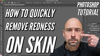 Photoshop Tutorial:  How to quickly REMOVE Redness on Face & Skin