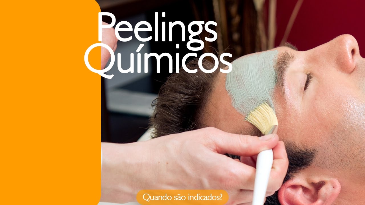 Peelings Químicos