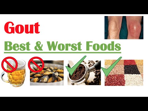 , title : 'Best & Worst Foods to Eat with Gout | Reduce Risk of Gout Attacks and Hyperuricemia'