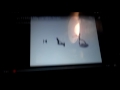 My Cartljhh Waiting For Scan