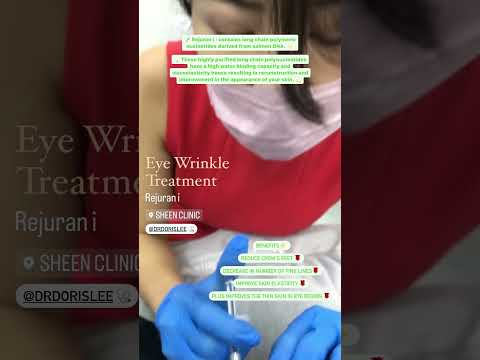 Revitalize Your Gaze: Rejuran I Eye Healer Treatment