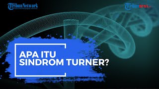 Apa Itu Sindrom Turner?