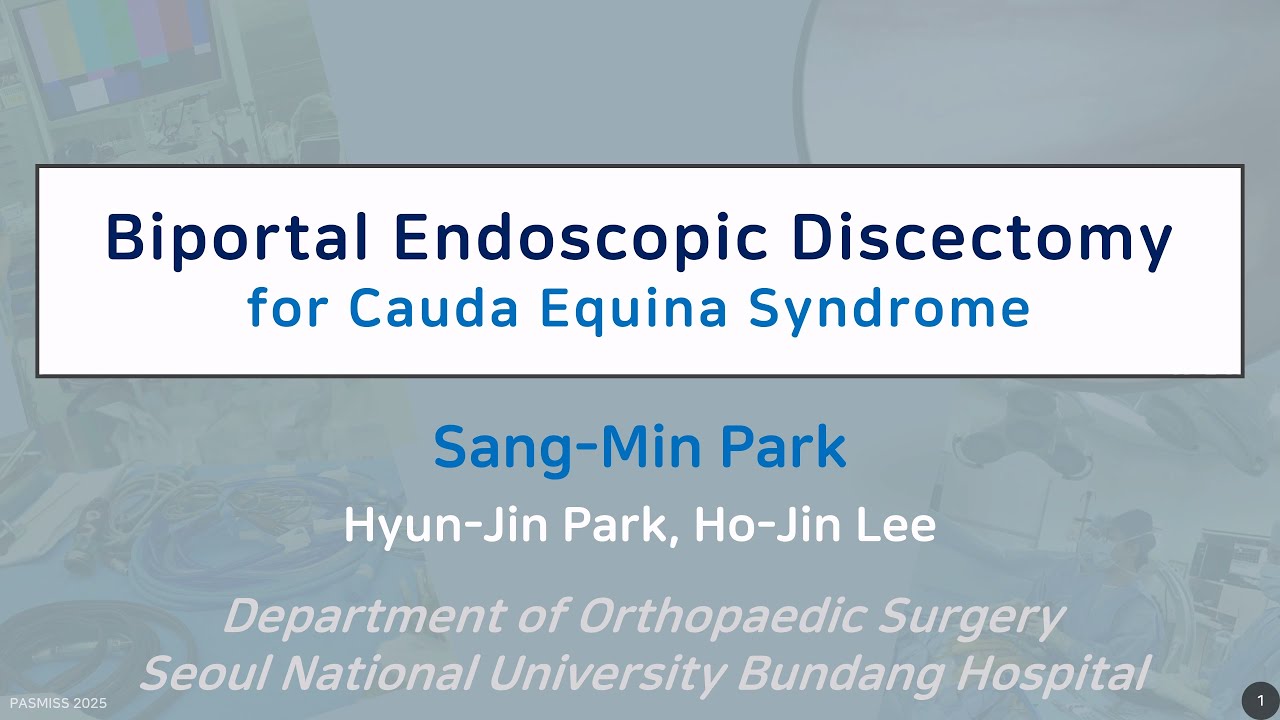 Decompression Surgery Thumbnail