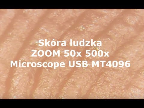 Wyeliminowanie deformacji stóp Guzek na ścięgien stóp jako uczta