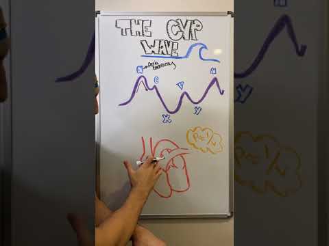 The CVP Wave