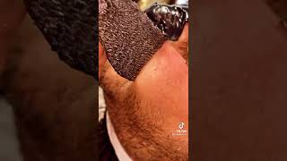 [閲覧注意]毛穴パック レベル100