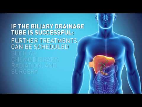 Biliary Drain