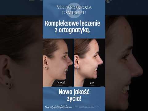 Marta Krzyżanowska-11