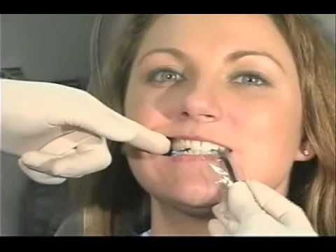 Henry Schein UK - Carestream RVG Positioning