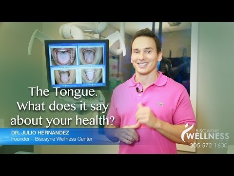 image-What can Chinese medicine tell from your tongue?