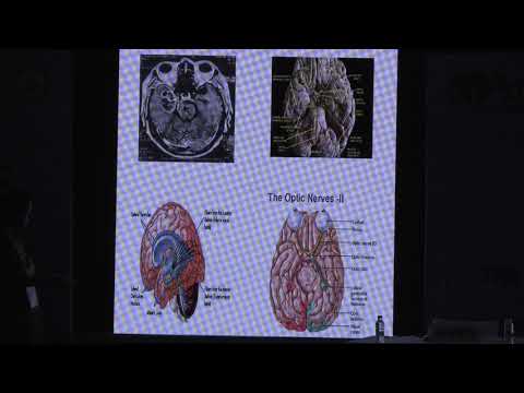 AIOC2019 - IC042 - Decision making in Neuro-ophthalmological Disorders: Case based teaching