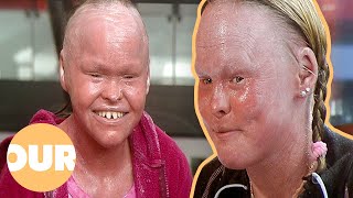 Download lagu My Skin Could Kill Me | Our Life mp3 Download lagu My Skin Could Kill Me | Our Life mp3