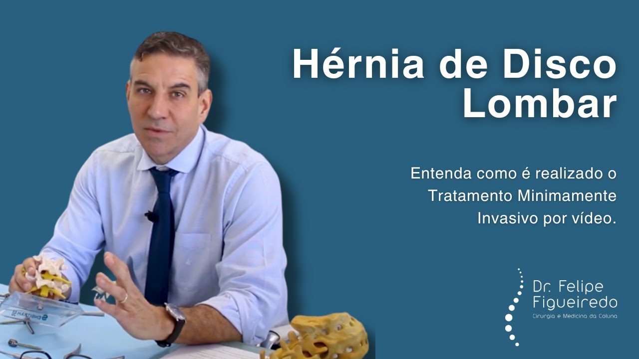 Felipe Figueiredo-21