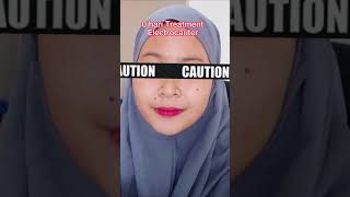 Download lagu Treatment Electrocauter Untuk Menghilangkan Tahi Lalat Di Wajah | Lavees Clinic mp3