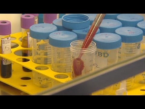 Coronavirus unter Umständen auch unter Menschen übertragbar