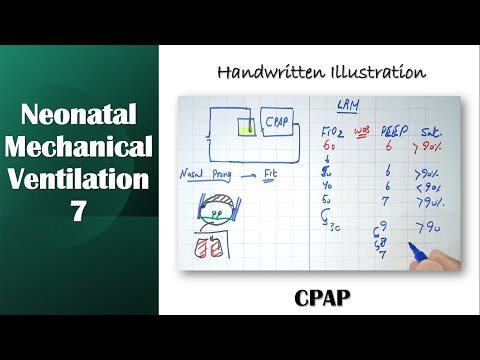 Neonatal Mechanical Ventilation 7 | CPAP | Handwritten illustration