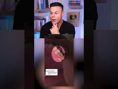 How Did He Brush Everyday And STILL Get Cavities?! 🦷🪥