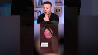 How Did He Brush Everyday And STILL Get Cavities?! 🦷🪥