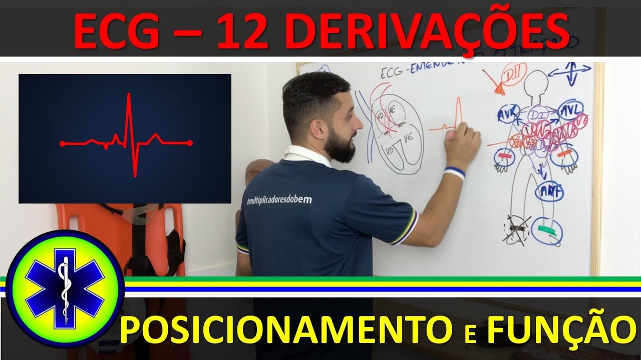INTRODUÇÃO AO ECG - POSICIONAMENTO E FUNÇÃO DAS 12 DERIVAÇÕES