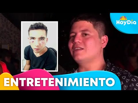 Remmy Valenzuela habla por primera vez de la golpiza que le dio su primo | Hoy Día | Telemundo