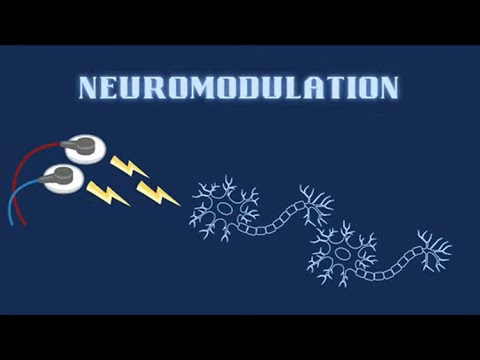 Neuromodulation: The Development of a New Frontier