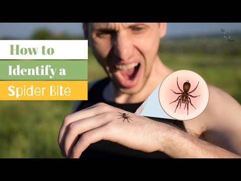 Identifying Spider Bites: How to Recognize and Treat Spider Bite Symptoms | The Guardians Choice